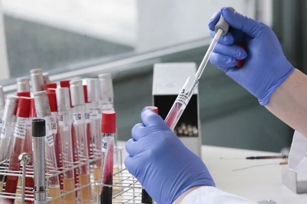 deputatdan-teklif-koronavirus-testlerinin-qiymeti-endirilsin