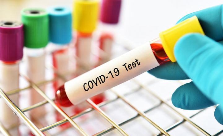 bakida-5-muellim-ve-mektebehazirliq-qrupundaki-1-usaqda-koronavirus-askarlanib